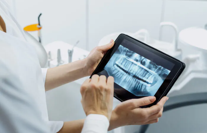 Digital Dental X-Rays
