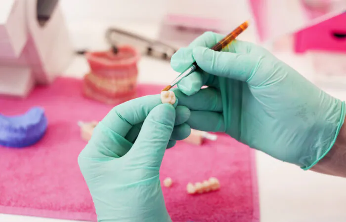 Aesthetic & Implant Crowns